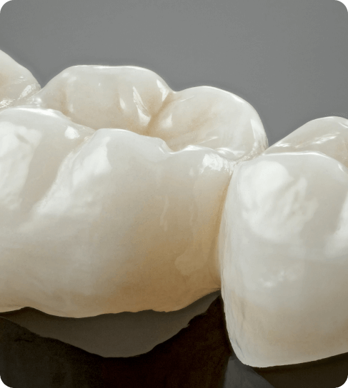 Dental Crowns