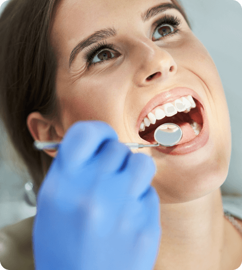Dental Fillings