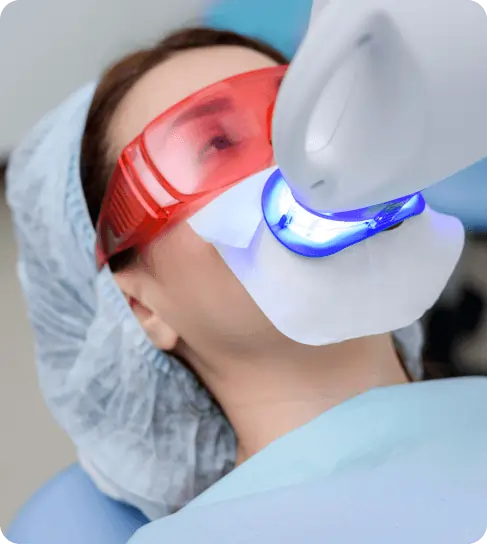 Teeth Whitening