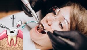 When a Dental Filling Is Enough to Restore Your Tooth